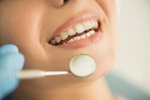 超清4k牙科牙齒口腔健康素材圖片